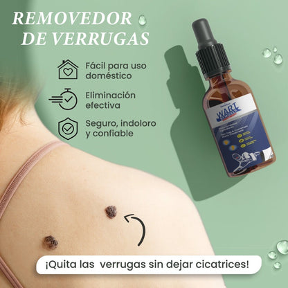Wart Remover